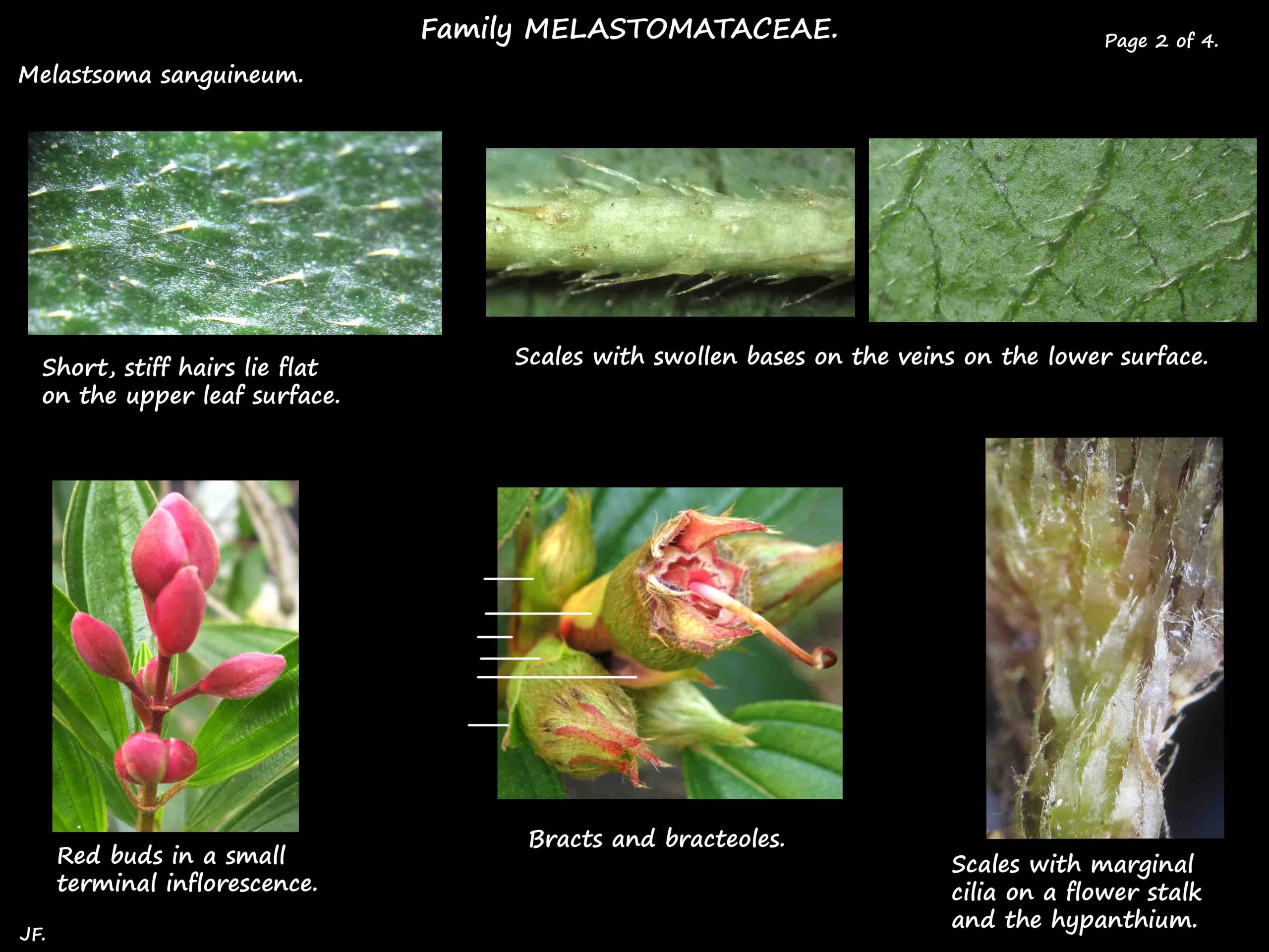 2 Melastoma sanguineum leaf hairs & scales